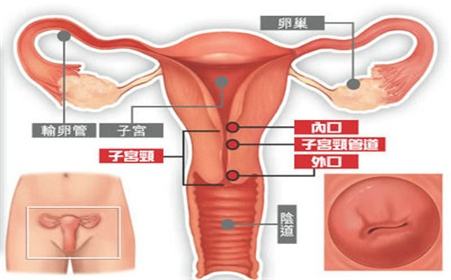 子宫内膜炎是怎么引起的？(图2)